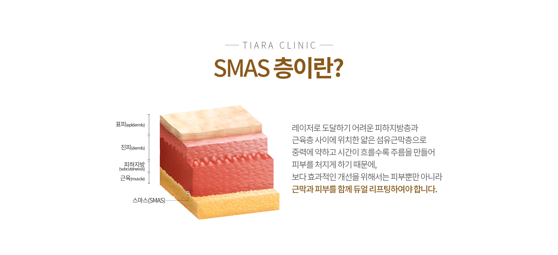 smas̶?